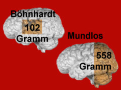 Hirnmasseverlust bei Bhnhardt / bei Mundlos - Grafik: Samy